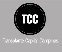 Transplante Capilar Campinas
